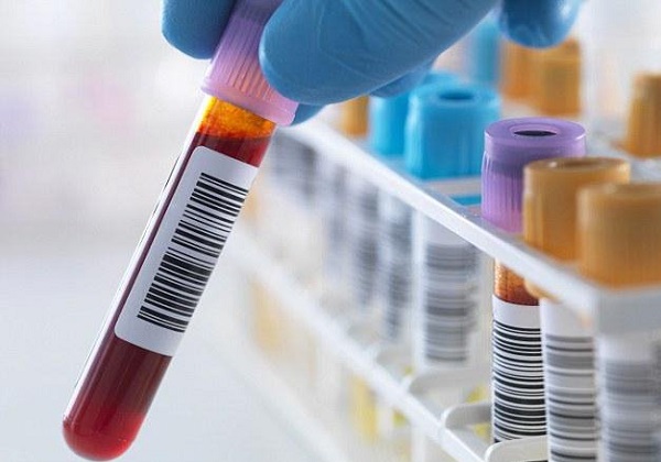 ساخت کوچکترین میکروسکوپ جهان به اندازه یک سوزن!