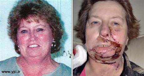 اتفاق عجیب در عمل‌های جراحی (+عکس)