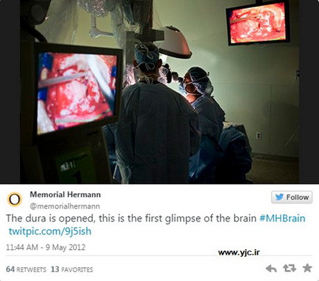 اتفاق عجیب در عمل‌های جراحی (+عکس)