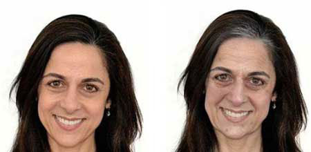 آنچه استرس بر سر صورت می‌آورد (+عکس)