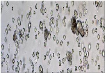 تولید واکسن‌های سه‌بعدی برای مبارزه با سرطان و ایدز