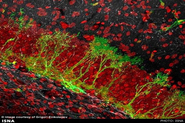 خشم چگونه ساختار مغز را تغییر می‌دهد؟