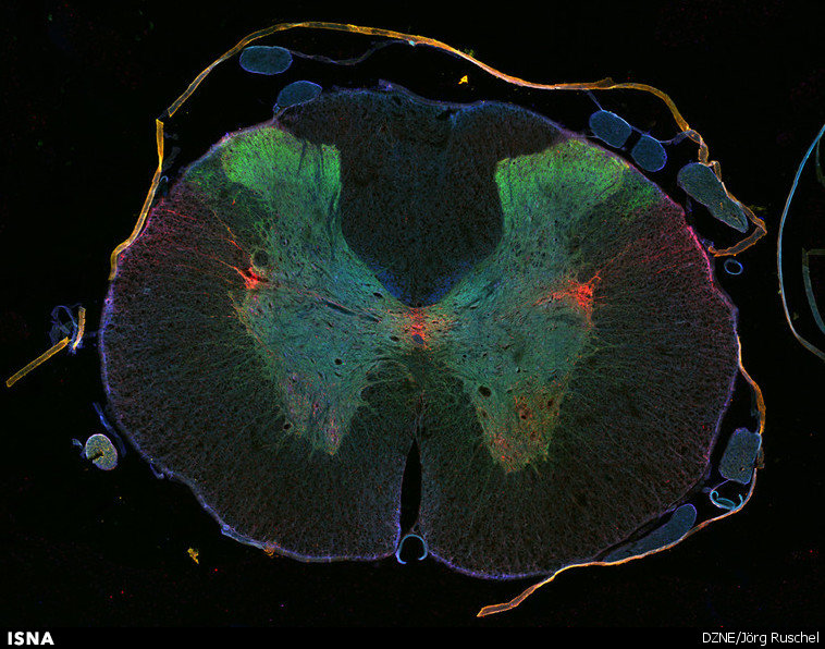 ارائه روشی جدید برای درمان آسیب‌های نخاعی