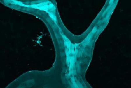 کشف یک ویژگی مهم در استخوان اسفنجی کشف یک ویژگی مهم در استخوان اسفنجی