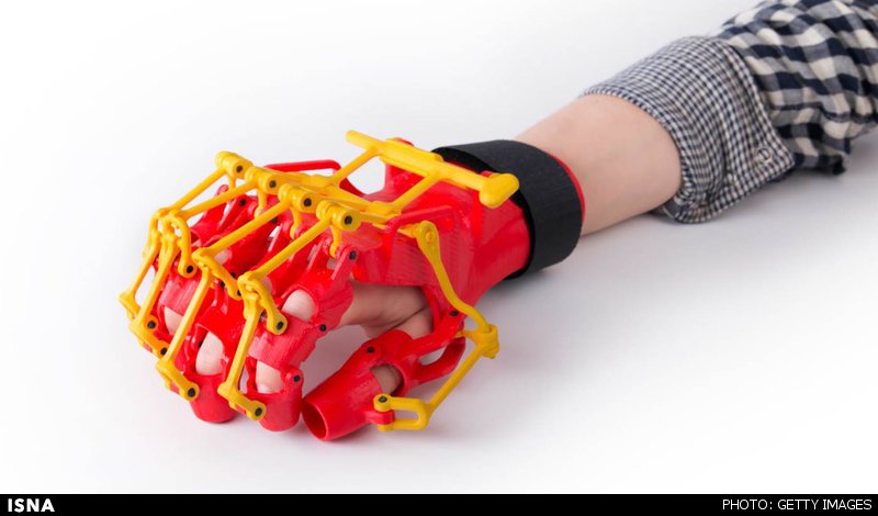 ساخت ارتز دست با فناوری چاپ سه بعدی ساخت ارتز دست با فناوری چاپ سه بعدی