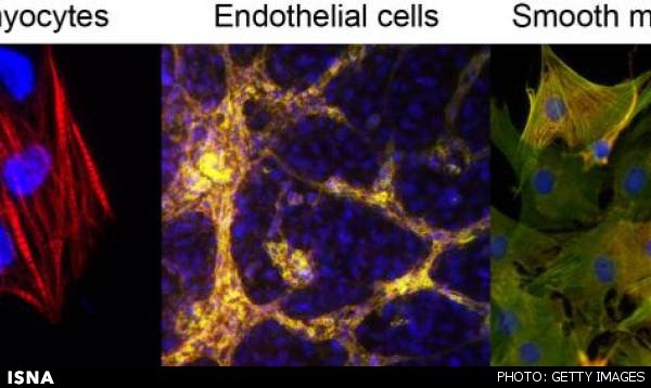 دستاوردی ارزشمند در حوزه درمان بیماری‌های قلبی