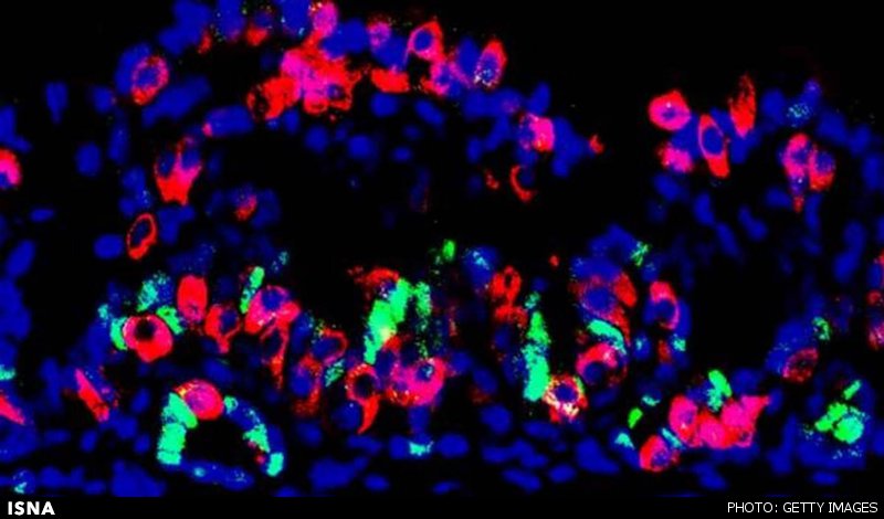 تولید معده کوچک آزمایشگاهی که انسولین تولید می‌کند
