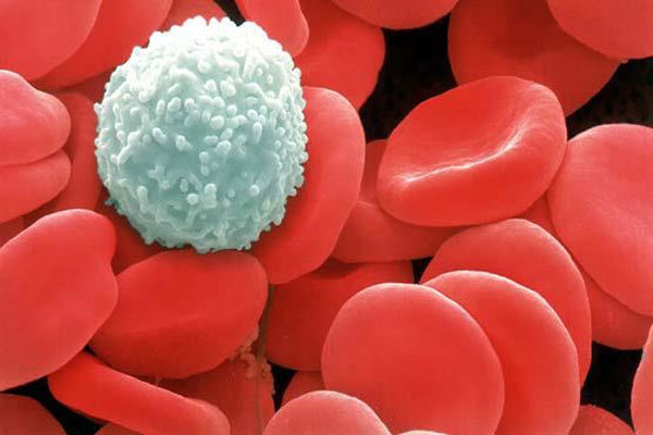 ساخت نانوحامل هوشمند برای درمان سرطان خون
