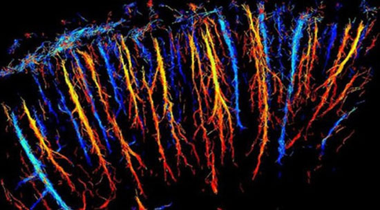 اولین اسکن 3 بعدی مغز (+عکس)