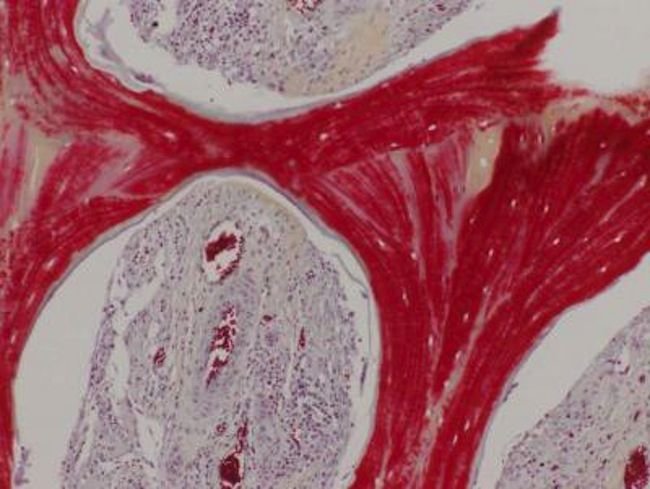 تولید استخوان زنده در آزمایشگاه تولید استخوان زنده در آزمایشگاه