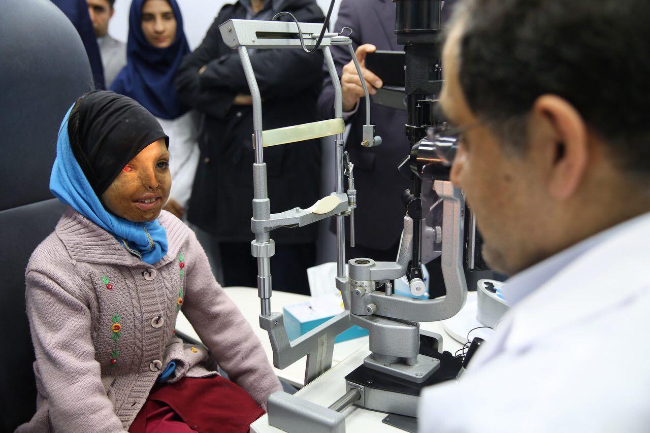 وزیر بهداشت، دختر قربانی اسیدپاشی را معاینه کرد (+عکس)