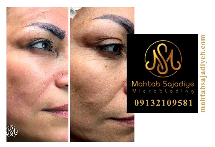 چگونه پوست خود را چندین سال جوان تر کنیم؟