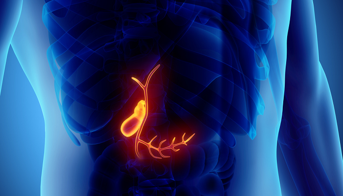 وقتی کیسه صفرا حمله می&zwnj;کند!