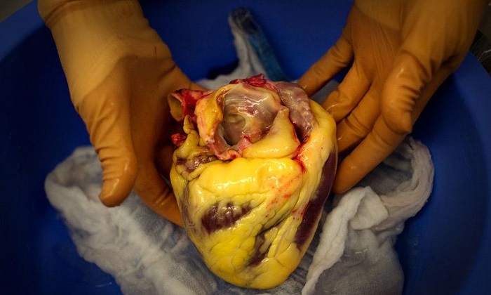 بهترین روش برای کاهش یک چربی خطرناک بهترین روش برای کاهش یک چربی خطرناک