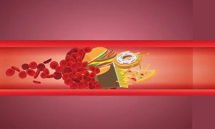 درباره ارتباط رژیم غذایی و کلسترول!