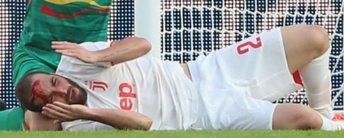 مهاجم یوونتوس راهی بیمارستان شد (+عکس)