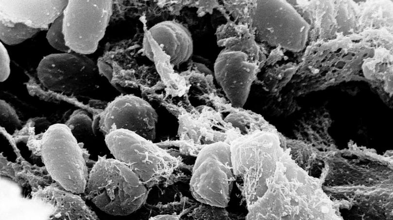 از طاعون سیاه تا کرونا