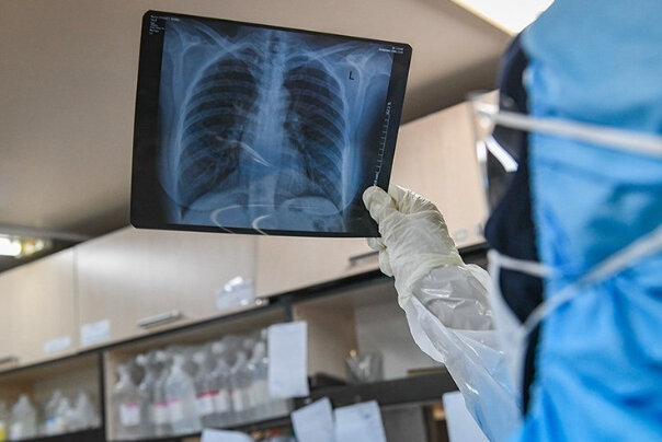 کرونا در انگلیس