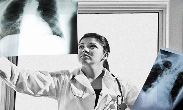 التهاب عضله میوکارد قلب؛ از دلایل تا عوارض