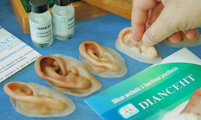 پروتزهایی که زندگی انسانها را تغییر میدهند پروتزهایی که زندگی انسانها را تغییر میدهند