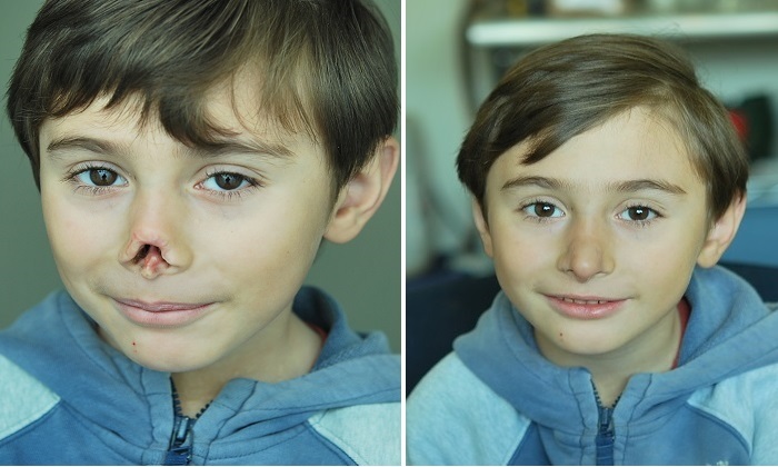 پروتزهایی که زندگی انسانها را تغییر میدهند پروتزهایی که زندگی انسانها را تغییر میدهند