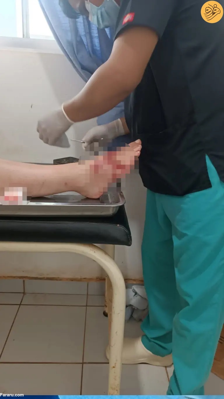 دلفین بخشی از پای زن شناگر را خورد (+عکس) دلفین بخشی از پای زن شناگر را خورد (+عکس)