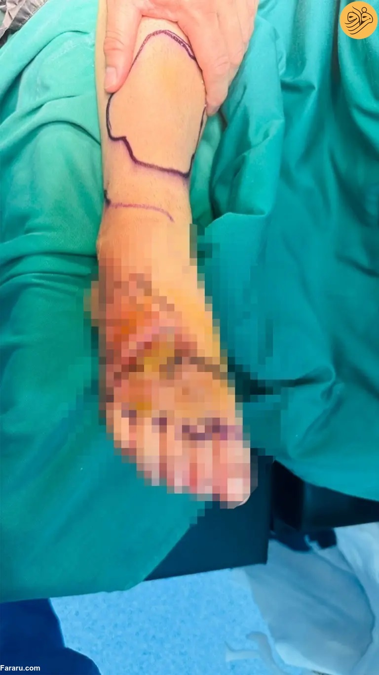 دلفین بخشی از پای زن شناگر را خورد (+عکس) دلفین بخشی از پای زن شناگر را خورد (+عکس)