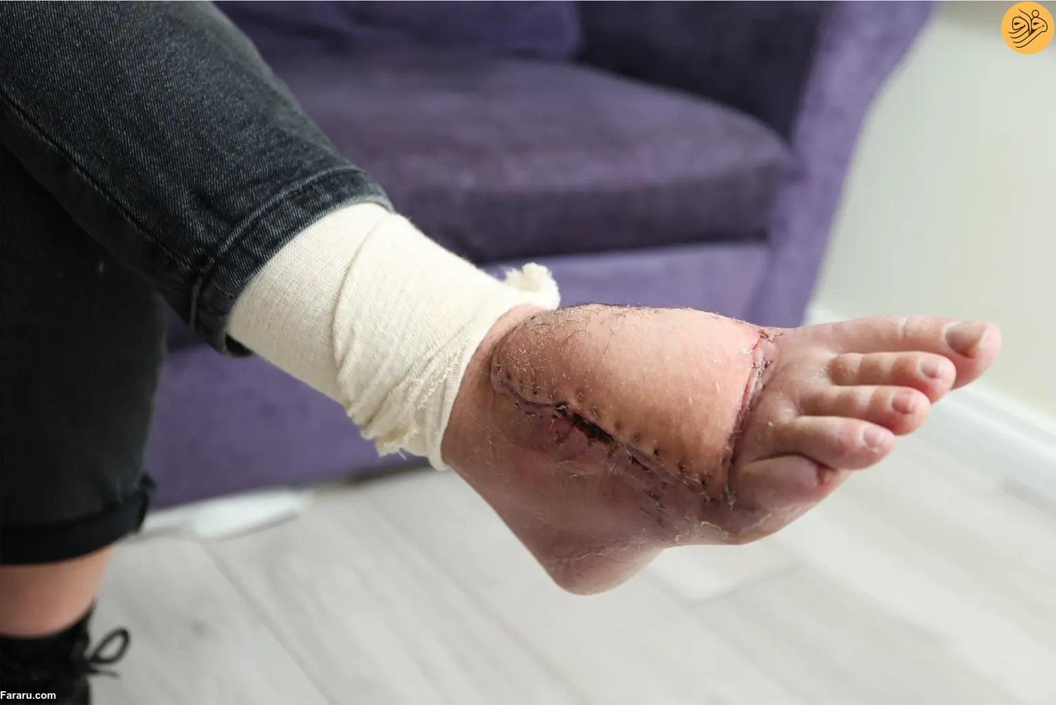 دلفین بخشی از پای زن شناگر را خورد (+عکس) دلفین بخشی از پای زن شناگر را خورد (+عکس)