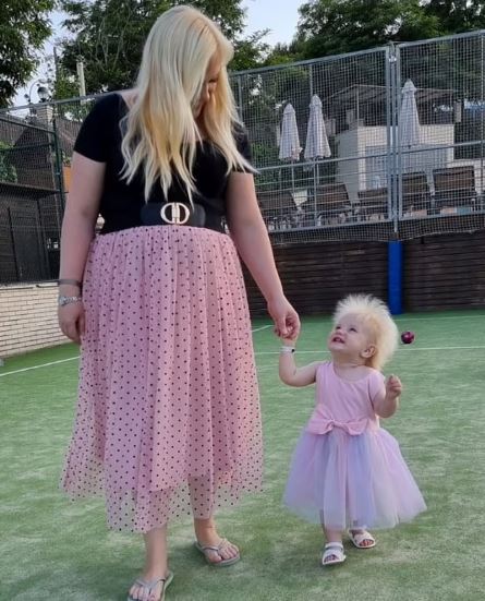 کودک ۱۷ ماهه مبتلا به سندرم موهای شانه نشدنی (+عکس و فیلم) کودک ۱۷ ماهه مبتلا به سندرم موهای شانه نشدنی (+عکس و فیلم)