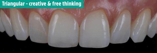 دندان های شما در مورد شخصیت تان چه می گویند؟