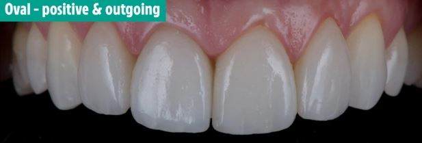 دندان های شما در مورد شخصیت تان چه می گویند؟