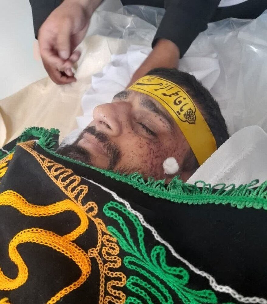 تصویر امام جماعت مسجد شیعیان در زاهدان بعد از ترور (عکس)