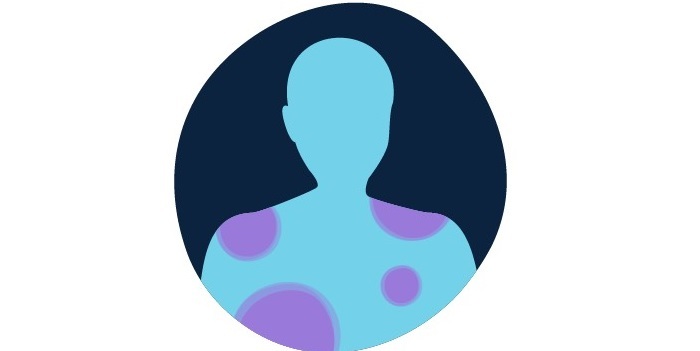 سرطان خون و همه چیز درباره نشانه های آن سرطان خون و همه چیز درباره نشانه های آن