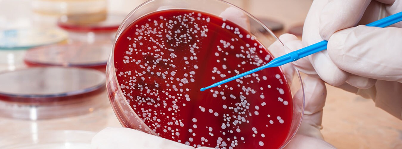 سرطان خون و همه چیز درباره نشانه های آن سرطان خون و همه چیز درباره نشانه های آن