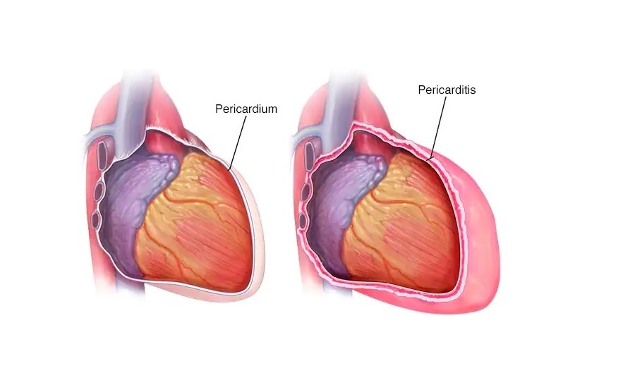 نشانگان درسلر چیست و چه اهمیتی دارد؟ نشانگان درسلر چیست و چه اهمیتی دارد؟