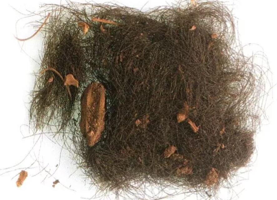 موی انسان موی انسان