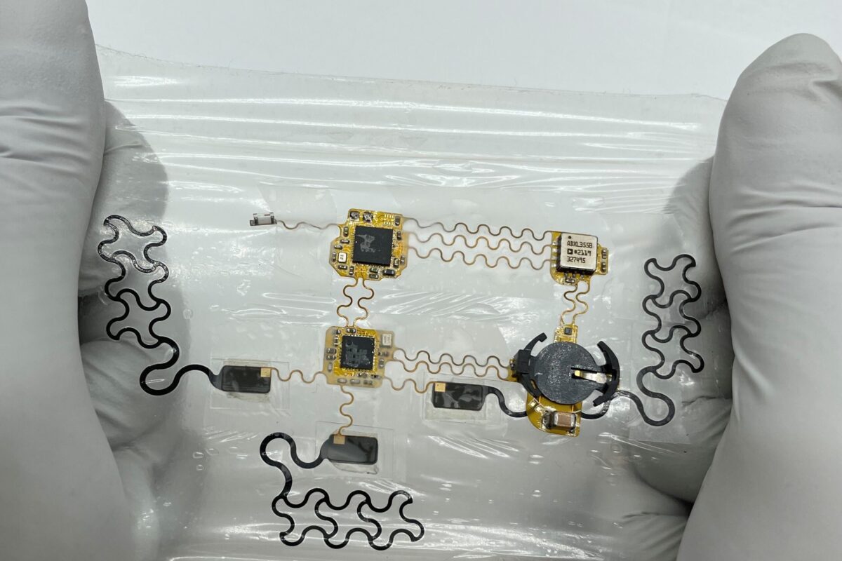 تحول در نظارت بر سلامت قلب با ئی-تتو