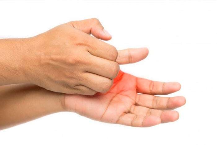 خارش کف دست