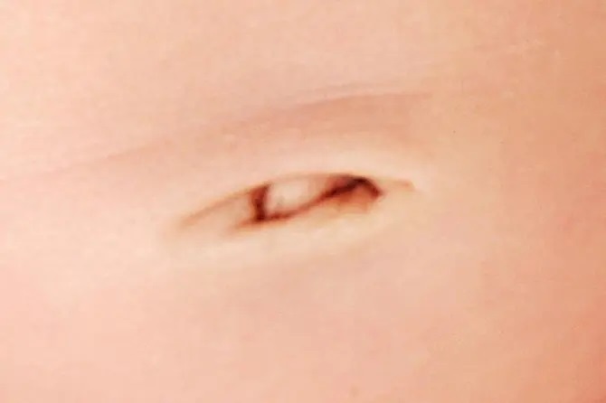 ناف افقی ناف افقی