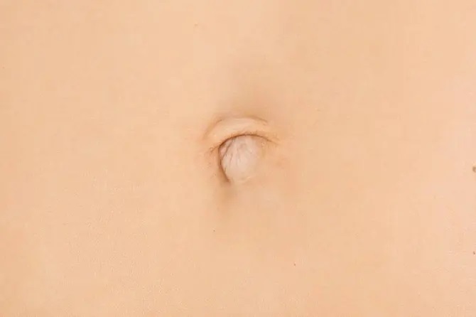 ناف بسته ناف بسته