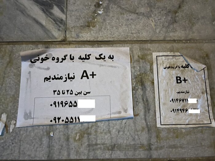  عضو بدن شما را خریداریم! / فروش دلاری کلیه با سفر ایرانی ها به ترکیه و عراق