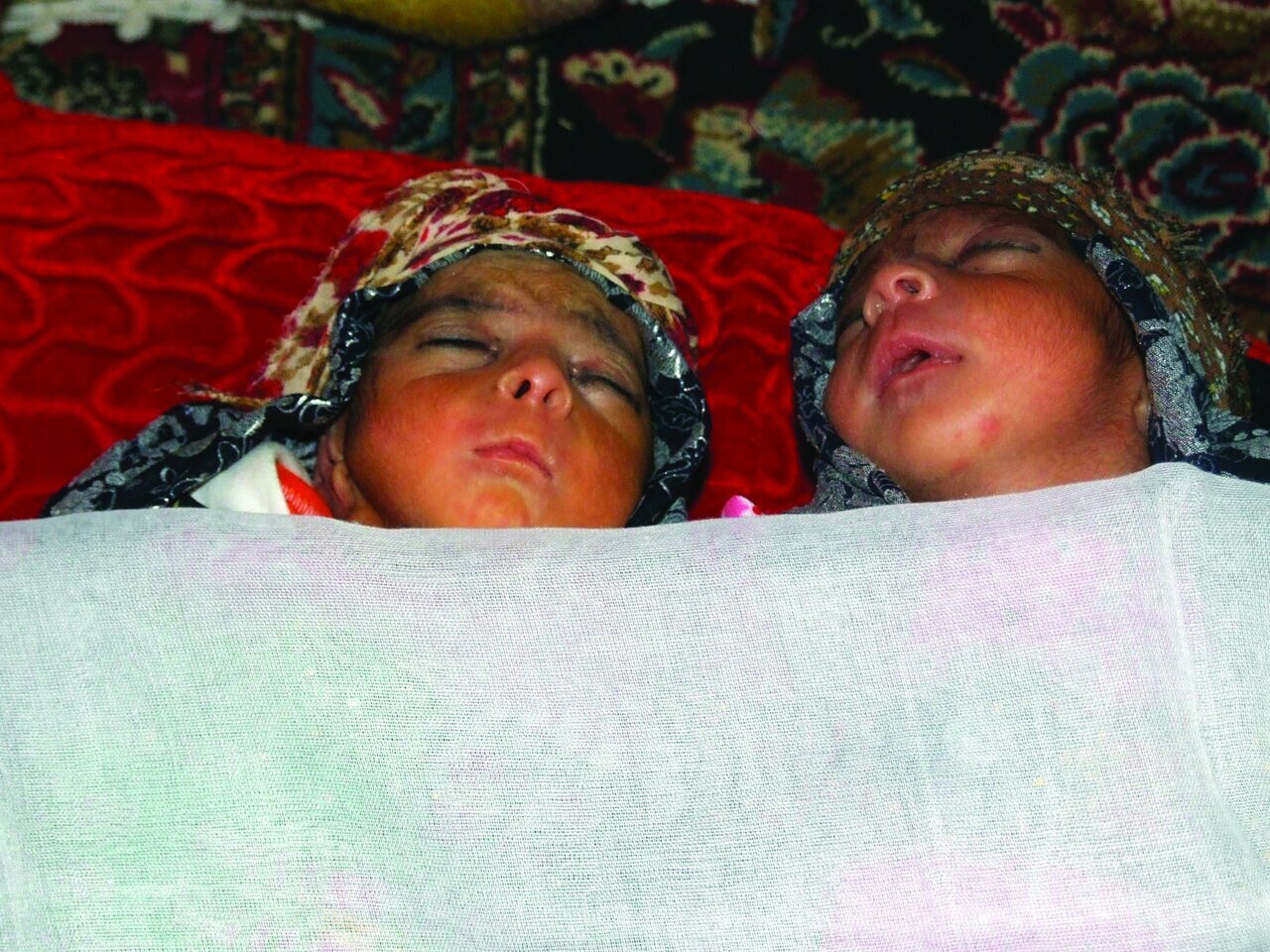 من، ۱۷ ساله، ۴ قلو دارم من، ۱۷ ساله، ۴ قلو دارم