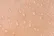 عرق چه تاثیری بر سلامت پوست دارد؟