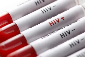 آخرین وضعیت عفونت ایدز ( HIV) در کشور