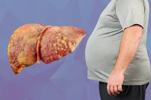 اگر شکمتان آب نمی‌شود، به جای رژیم، کبدتان را چک کنید