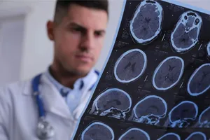 اختلال خواب فقط شما را خسته نمی‌کند؛ ساختار مغزتان را هم تغییر می‌دهد