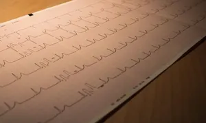 از سندرم مرگ ناگهانی بزرگسالان چه می‌دانید؟