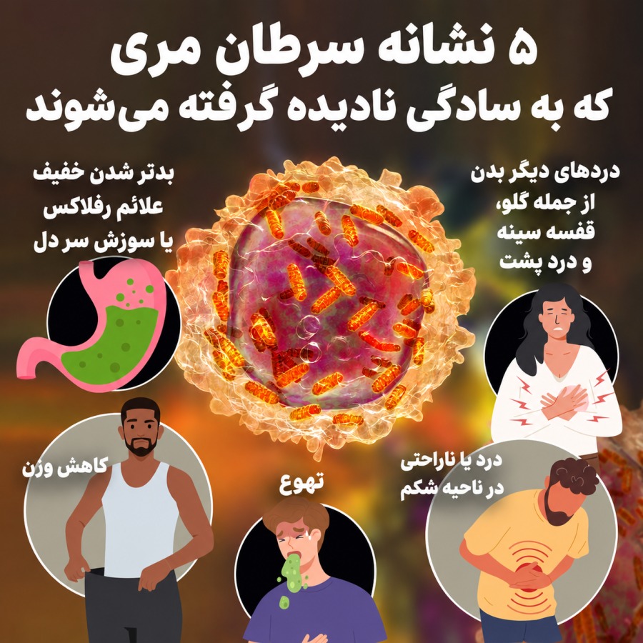 سرطان مری سرطان مری