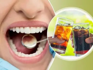 نوشابه های بدون قند هم می توانند به دندان آسیب بزنند