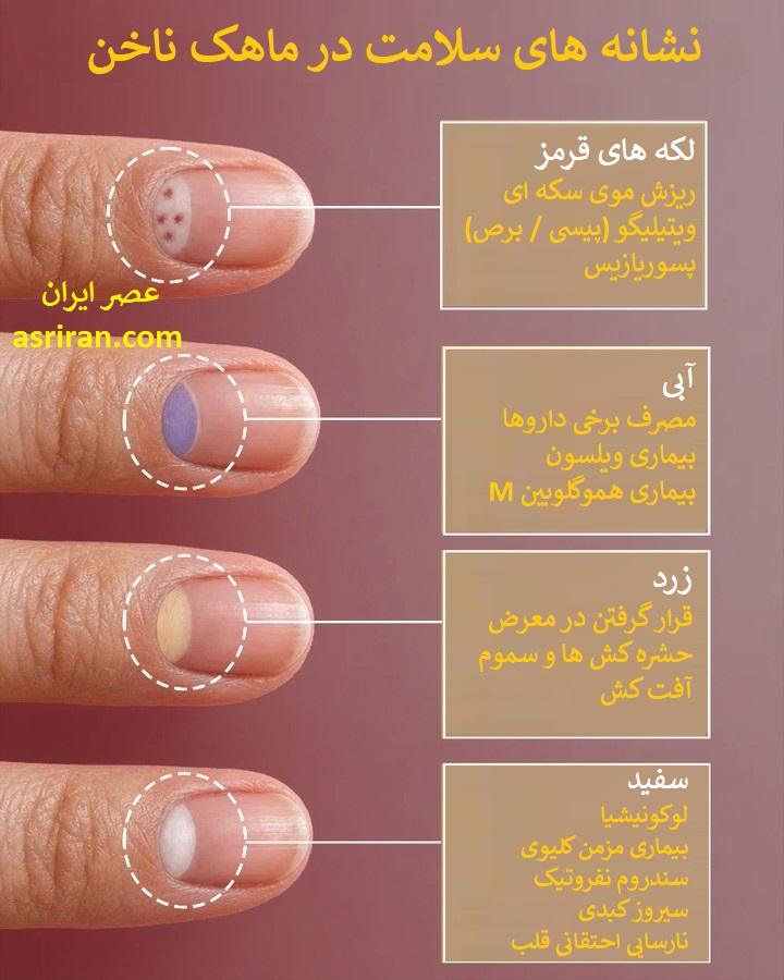 اینفوگرافیک نشانه های سلامت در ماهک ناخن اینفوگرافیک نشانه های سلامت در ماهک ناخن